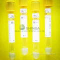 Gel and Clot Activator Blood Collection Tube (Yellow Cap)